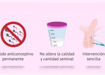 Anuncian vasectomía gratis en Centros de Salud del GCDMX
