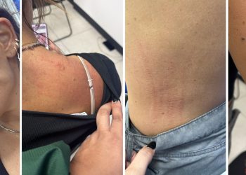 Colaboradores de Ale Rojo presentan lesiones delicadas